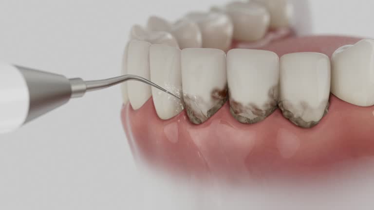 Reliable Dental contractor in Monroeville, IN by Dentist Open Now
